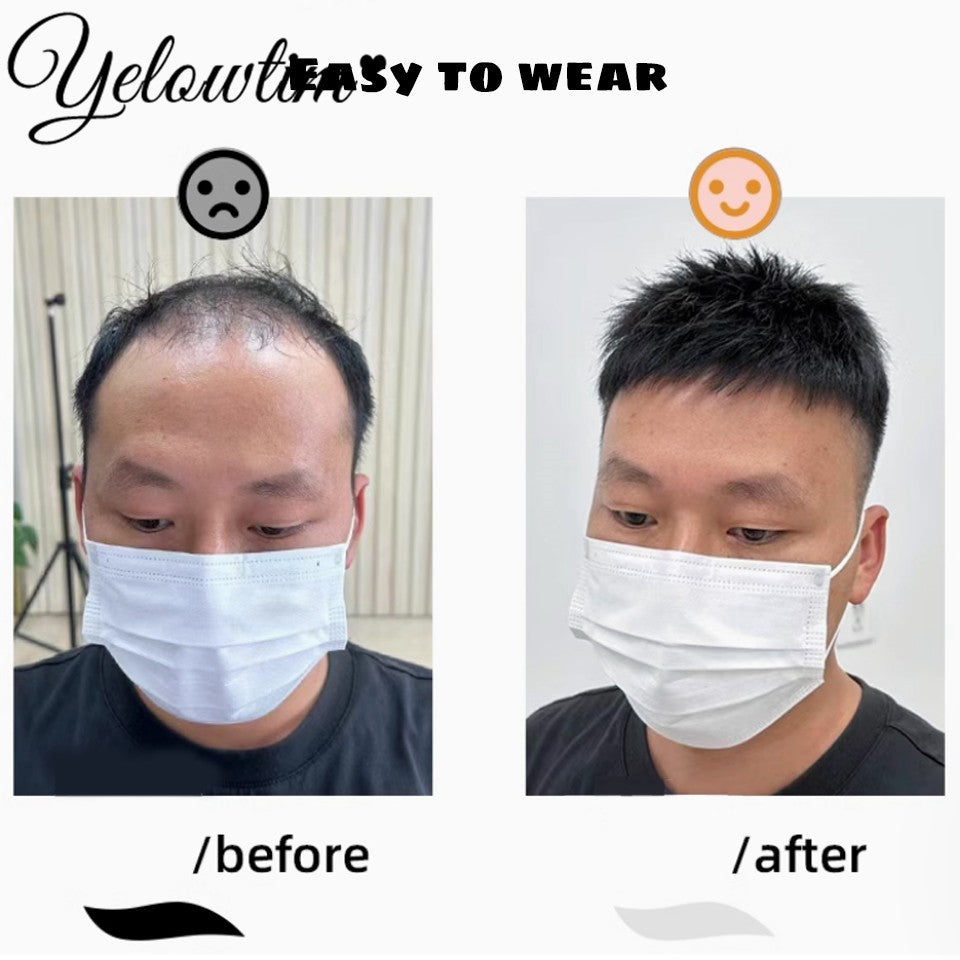 Peruca Masculina Sintética Curta com Topo de Cabelo Yelowtim para Jovens com Calvície, Queda de Cabelo, Entrada Alta, Extensões de Cabelo com Clip