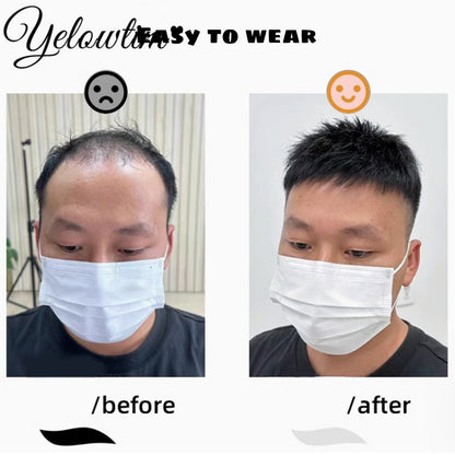 Peruca Masculina Sintética Curta com Topo de Cabelo Yelowtim para Jovens com Calvície, Queda de Cabelo, Entrada Alta, Extensões de Cabelo com Clip