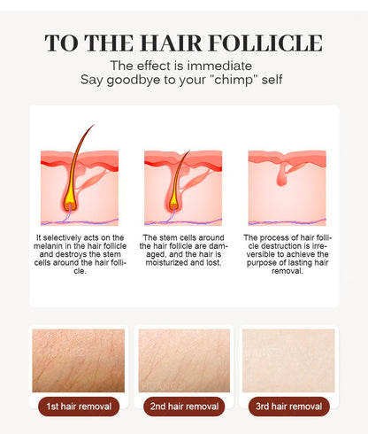 808nm Alexandrite Professional Soprano Diode Ice Titanium Laser Body Hair Removal Machine 4 Wave Device Permanent Woman 4000W