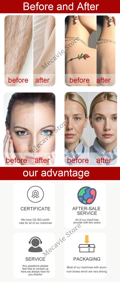 4-IN-1 NEW soprano titanium 755nm 808nm 940nm 1064nm diode laser 4000w permanent hair removal machine IPL tattoo removal machine