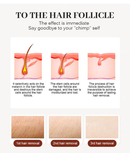 Portable 808 755nm Body Hair Laser Hair Removal Machine 3-Wave IPL Professional Diode Ice Titanium Permanent Painless