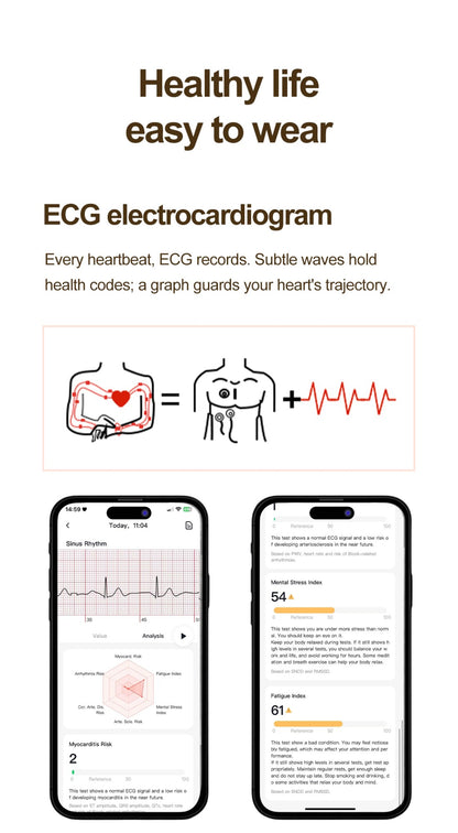NEW Women Smartwatch 1.32inch AMOLED Screen ECG Sport Watch Blood Pressure Micro physical examination AI dial Health Smart Watch