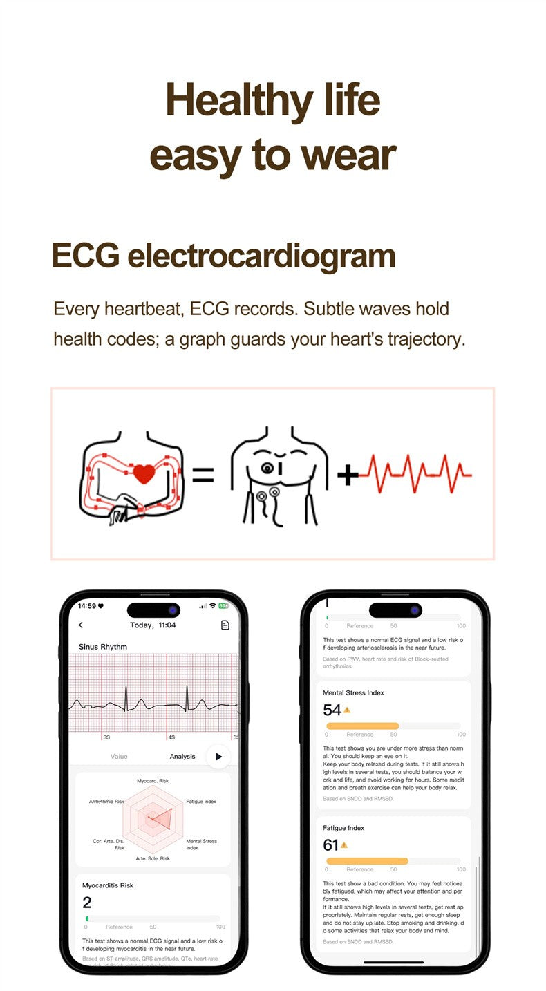 Women Smartwatch 1.32inch AMOLED Screen Call ECG Sport Watch Blood Pressure Micro physical examination AI dial Women Smart Watch