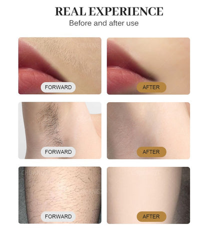 808nm Ice platinum Laser Diode Hair Removal Machine Permanent Best Painless Skin Care Device 3 Wavelength 808 1064 755nm