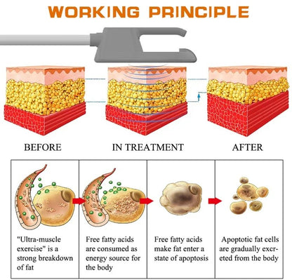 HIEMT EMSZERO RF High Intensity EVibration Pulse Electromagnetic Body Shaping Professional Muscle Growth And Fat Burning  Machin