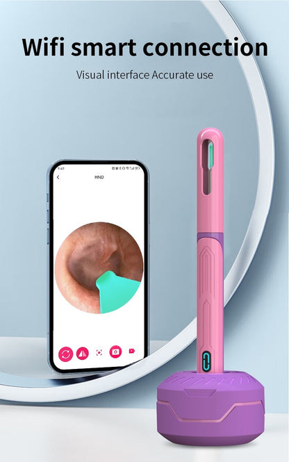 Conjunto de Limpeza de Ouvido com Câmera, Hastes para Ouvido, Otoscópio, Carregamento USB C, Ferramenta de Remoção de Cera com Endoscópio, Câmera Mini de Limpeza de Ouvido, Conjunto de Limpeza de Ouvido