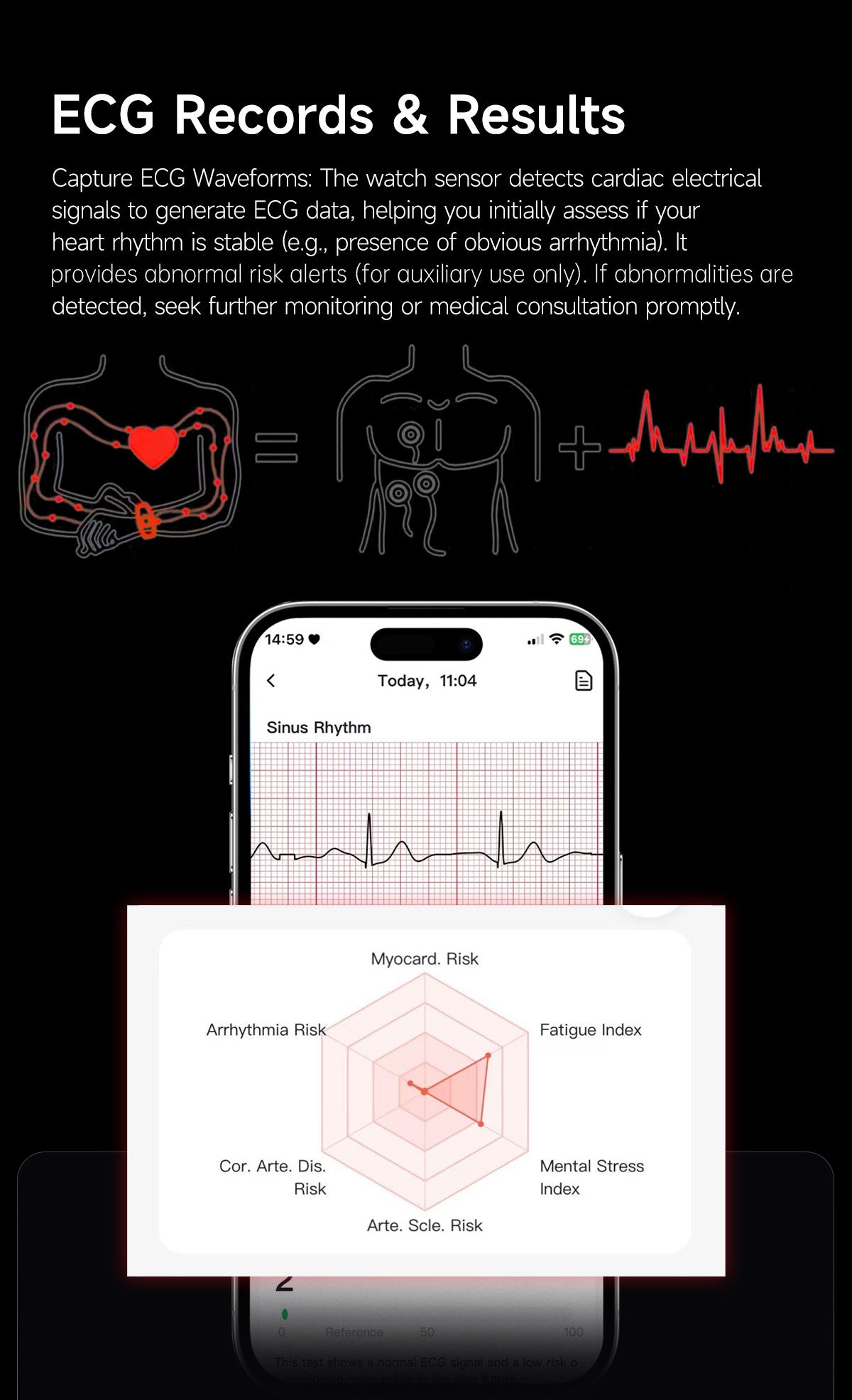 LIGE ECG+PPG Pulseira Inteligente Feminina Lipídios Sanguíneos Ácido Úrico Oxigênio no Sangue VFC Ciclo Menstrual Monitor Cardíaco Esportivo Relógio de Saúde Masculino