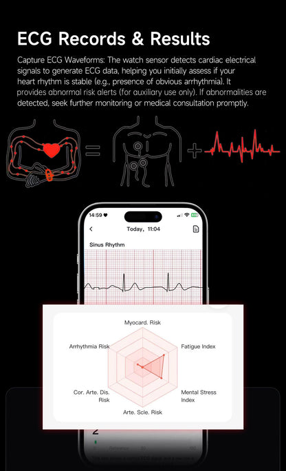 LIGE ECG+PPG Pulseira Inteligente Feminina Lipídios Sanguíneos Ácido Úrico Oxigênio no Sangue VFC Ciclo Menstrual Monitor Cardíaco Esportivo Relógio de Saúde Masculino