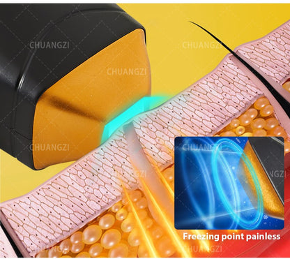 Portable 808 755nm Body Hair Laser Hair Removal Machine 3-Wave IPL Professional Diode Ice Titanium Permanent Painless