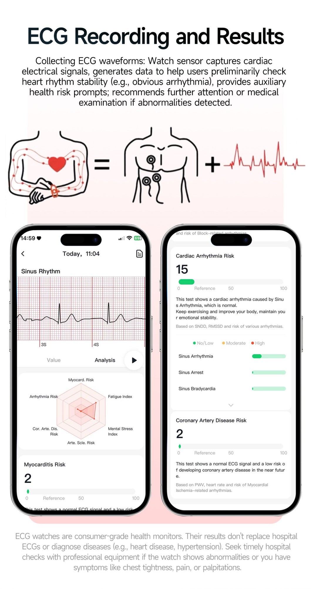 2026 New AI Health Diagnosis Smart Watch Body Analysis Uric Acid Blood lipids ECG+PPG Blood pressure call Smart watch Men Women