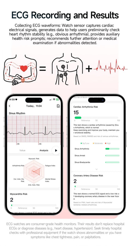 2026 New AI Health Diagnosis Smart Watch Body Analysis Uric Acid Blood lipids ECG+PPG Blood pressure call Smart watch Men Women