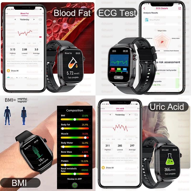 Smartwatch 2025 Novo ECG Chamada BT Feminino Frequência Cardíaca Lipídios Sanguíneos Ácido Úrico Saúde Monitores AI Voz 650mAh Esportivo