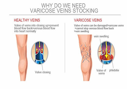 Varicose Veins Compression Socks Fit For Golf Rugby Hiking Sports For Anti Fatigue Driving Travel Flight Black Women Men Socks