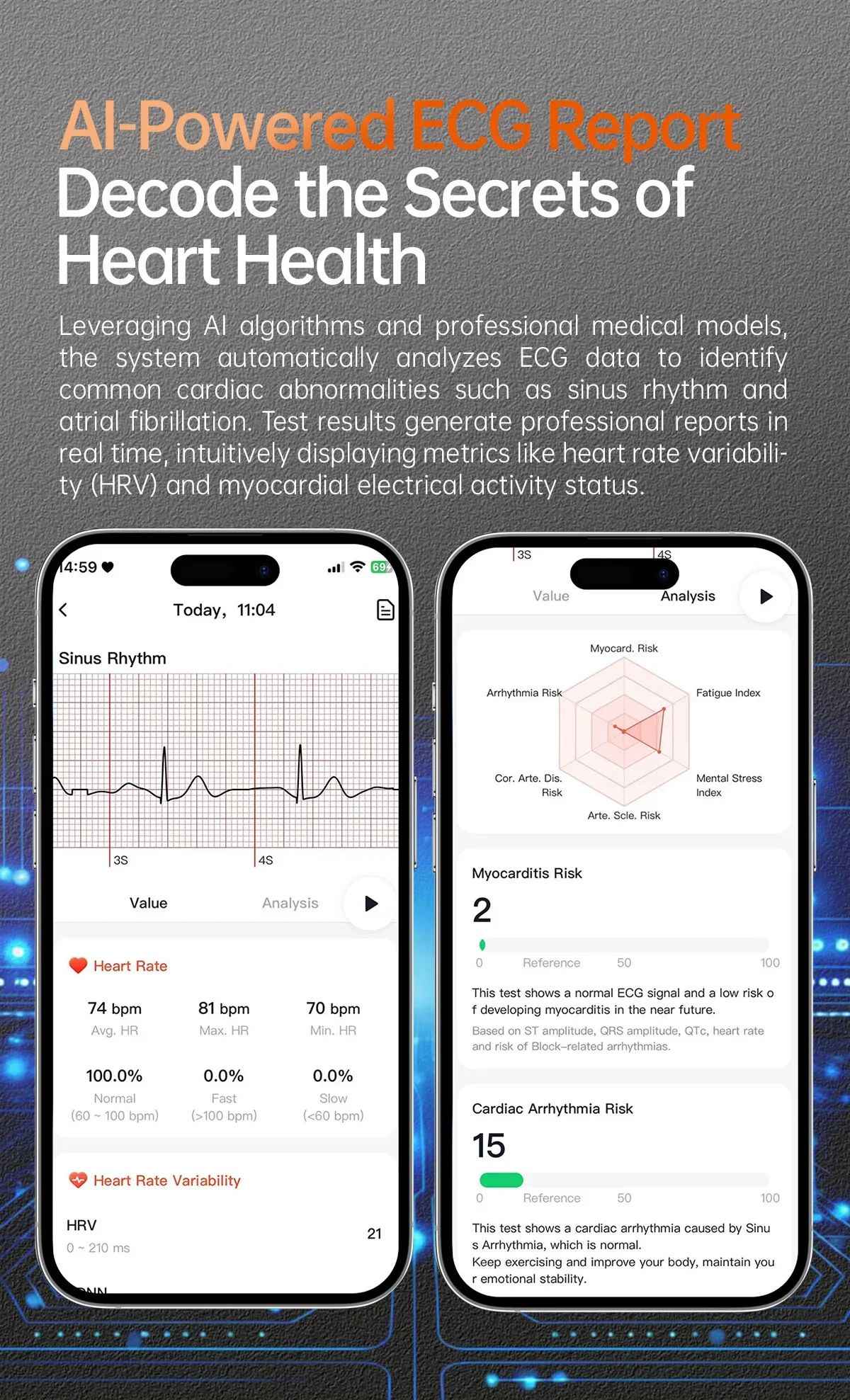 XIAOMI 704505 Novo Smartwatch ECG+PPG Preciso Ácido Úrico Lipídios Pressão Análise Corporal Smartwatch Masculino Chamada BT NFC
