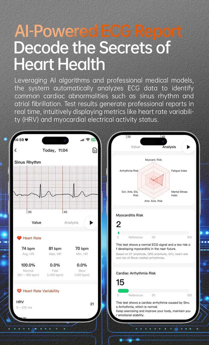 XIAOMI 704505 Novo Smartwatch ECG+PPG Preciso Ácido Úrico Lipídios Pressão Análise Corporal Smartwatch Masculino Chamada BT NFC