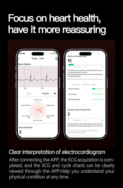 Relógio Inteligente Smartwatch Masculino 2026 Health Tracker com Safira e Medição de Ácido Úrico, Gordura Sanguínea, Pressão Arterial e ECG+PPG com Análise Corporal