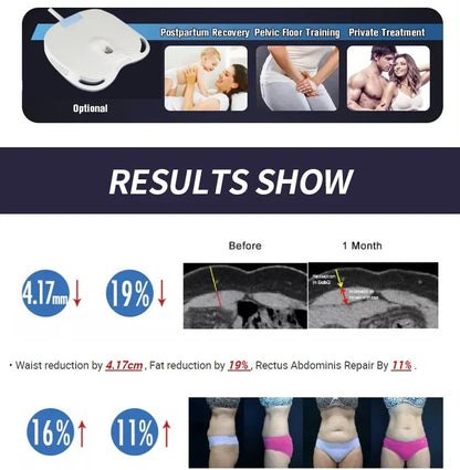 HIEMT EMSZERO RF High Intensity EVibration Pulse Electromagnetic Body Shaping Professional Muscle Growth And Fat Burning  Machin