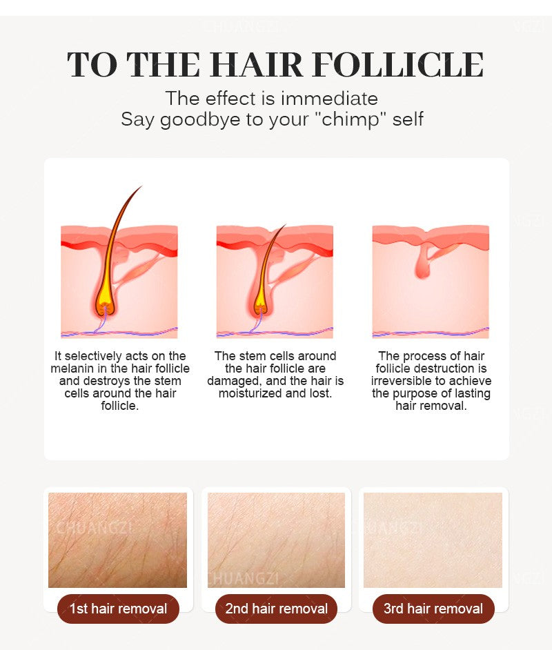 Ice Painless Diode Laser Hair Removal Machine 3 Wavelength 755nm 808nm 1064nm Epilation Definitive Suitable For All Skin Tones