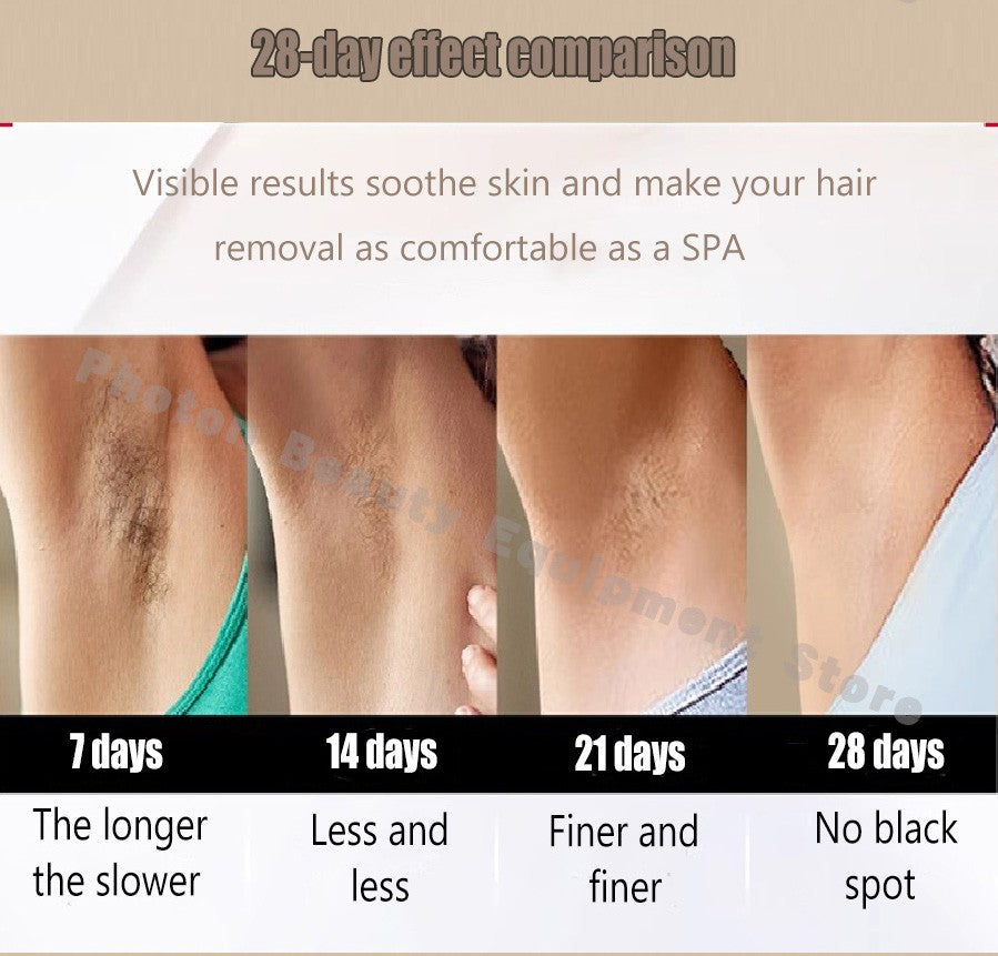 Professional Mini Diode Ice Titanium Laser Hair Removal Machine 755 940 1064 808nm 4000w Painless Permanent CE