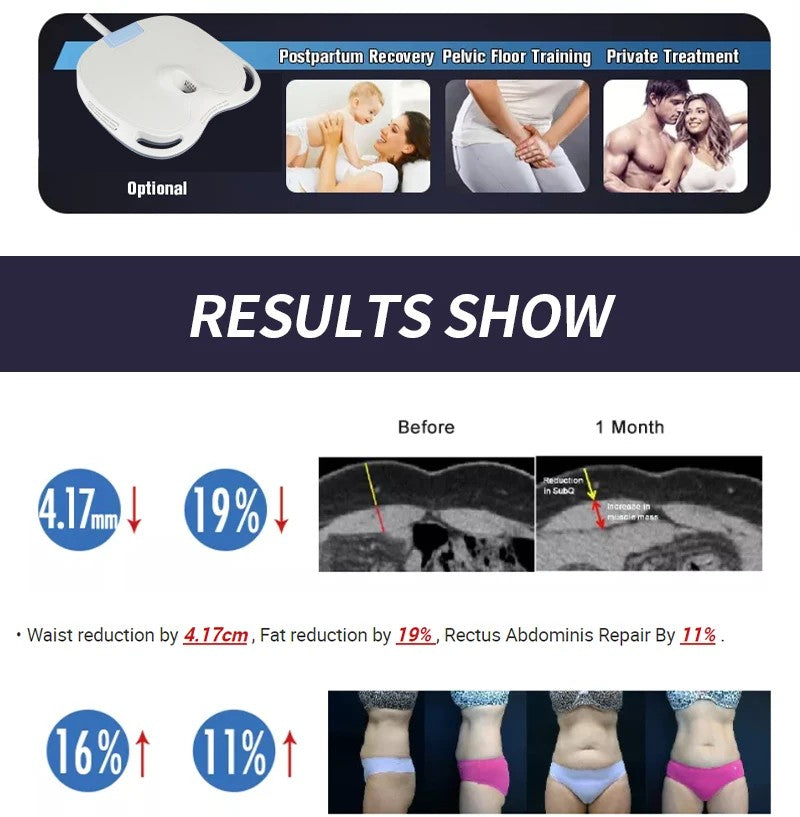 EMSzero HIEMT RF High Intensity Vibration Pulse Electronic Body Shaping Massage Muscle Massage