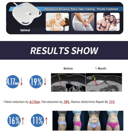 EMSzero HIEMT RF High Intensity Vibration Pulse Electronic Body Shaping Massage Muscle Massage