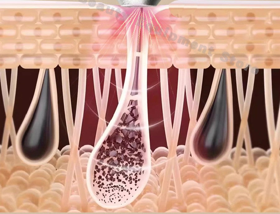 Professional Mini Diode Ice Titanium Laser Hair Removal Machine 755 940 1064 808nm 4000w Painless Permanent CE